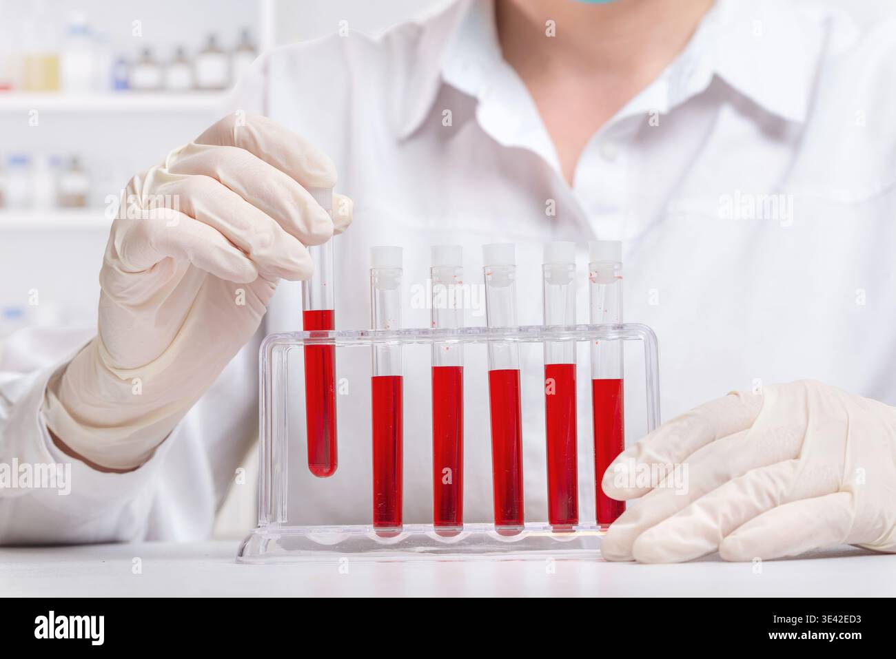 Nahaufnahme des Labortechnikers, der die Blutprobe in das Reagenzglasgestell, die medizinische Diagnostik und den wissenschaftlichen Testprozess einsetzt Stockfoto
