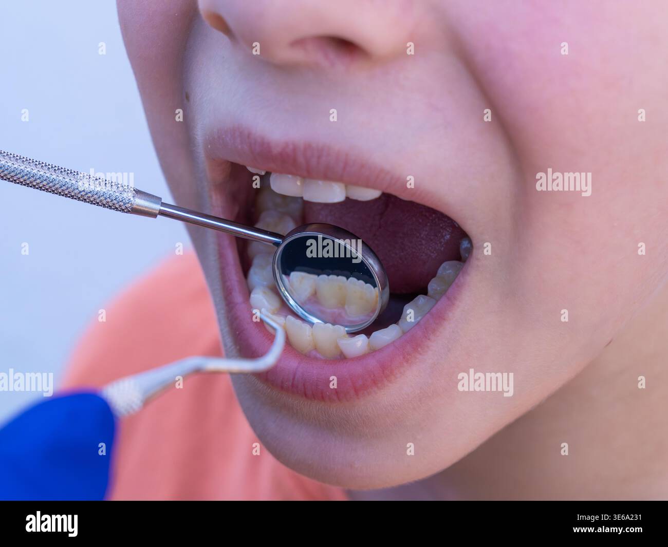 Kind in Zahnarztpraxis, Zahnarzt mit Instrumenten zur Mundgesundheitsuntersuchung Stockfoto