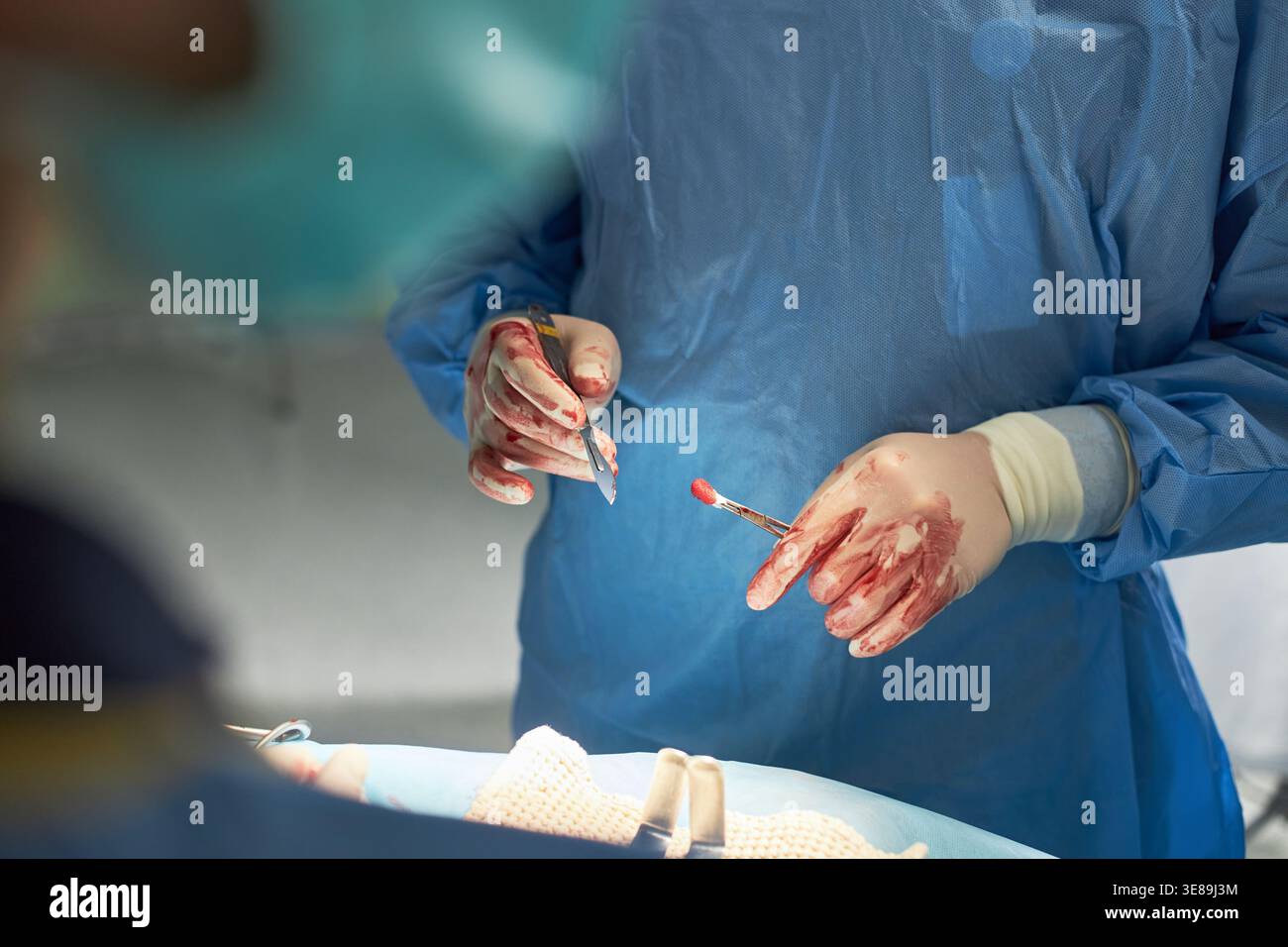 Nahaufnahme eines Chirurgen mit Skalpell, Blutproben-Tupfer während der Operation, mit sterilen chirurgischen Verfahren und klinischer Präzision. Nützlich für Gesundheitswesen, Chirurgie, Krankenhaus, medizinische Ausbildung Marketing Stockfoto