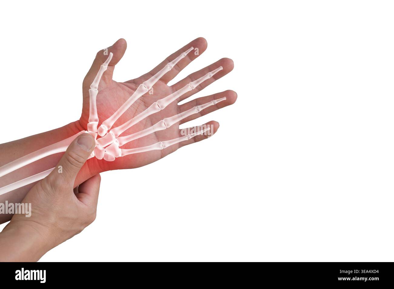 Medizinische Nahaufnahme einer Hand mit Skelettüberlagerung und roten Handgelenkschmerzen Highlight, die Knochenanatomie, Gelenkverletzung, Entzündung, Diagnose, und oder Stockfoto