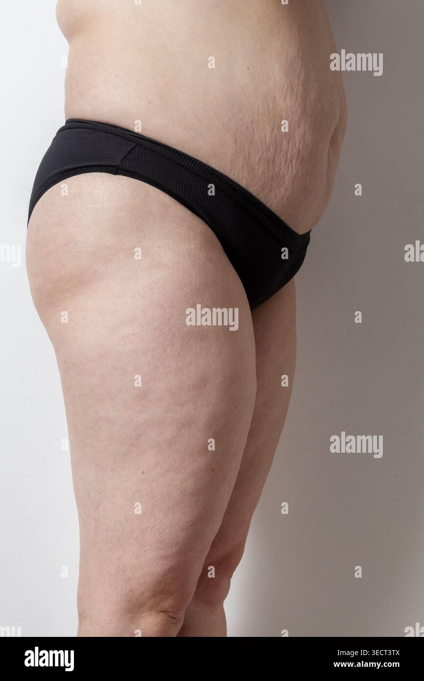 Dieses Bild zeigt die Schönheit des Alterns durch eine authentische Darstellung einer Reifen Frau. Durch die Hervorhebung der Hautstruktur und der Cellulite wird eine Botschaft vermittelt Stockfoto