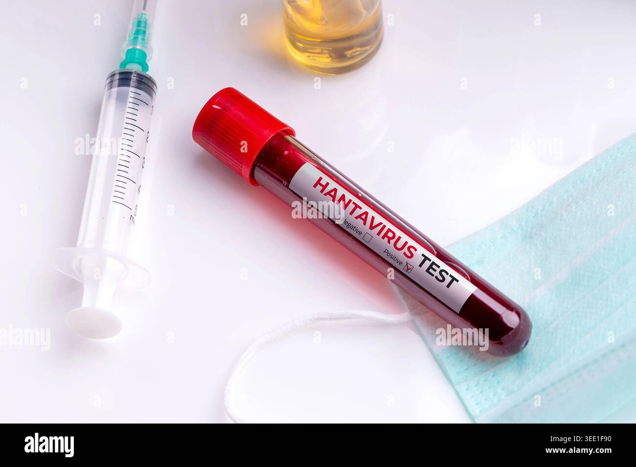 Blutprobe im Reagenzglas zur Hantavirus-Laboranalyse mit medizinischen Geräten Stockfoto