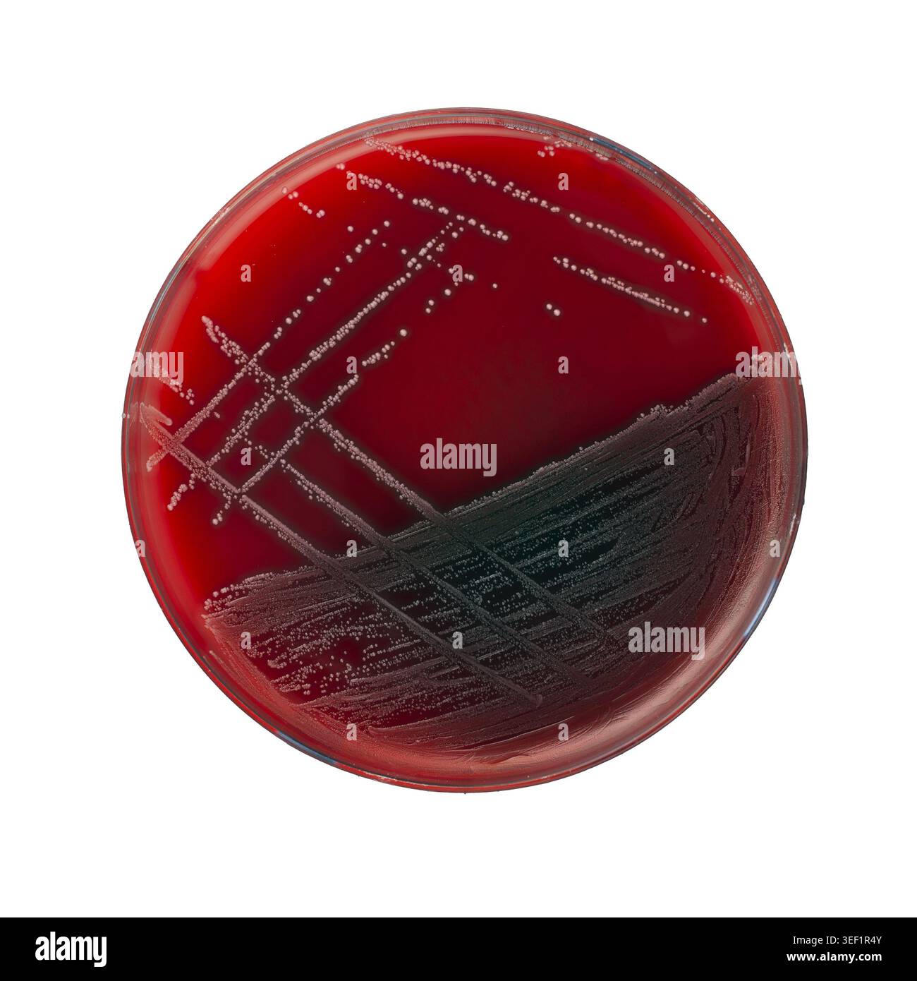 Reinkultur von Streptococcus pyogenes mit MALDI‑TOF MS auf Petrischale mit Blut-Agar Stockfoto