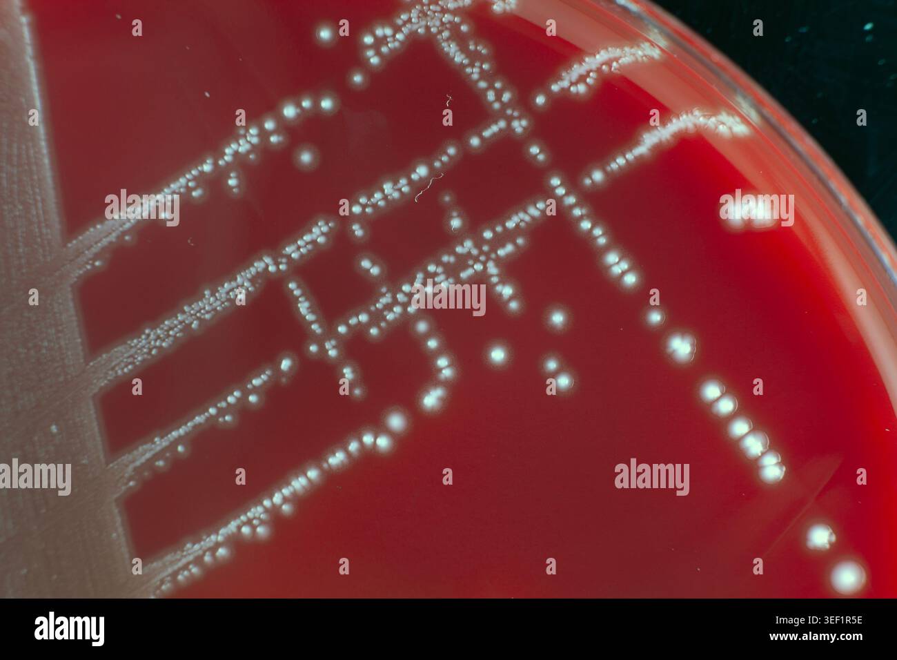 Reinkultur von Streptococcus gordonii mit MALDI-TOF MS auf Petrischale mit Blut-Agar Stockfoto