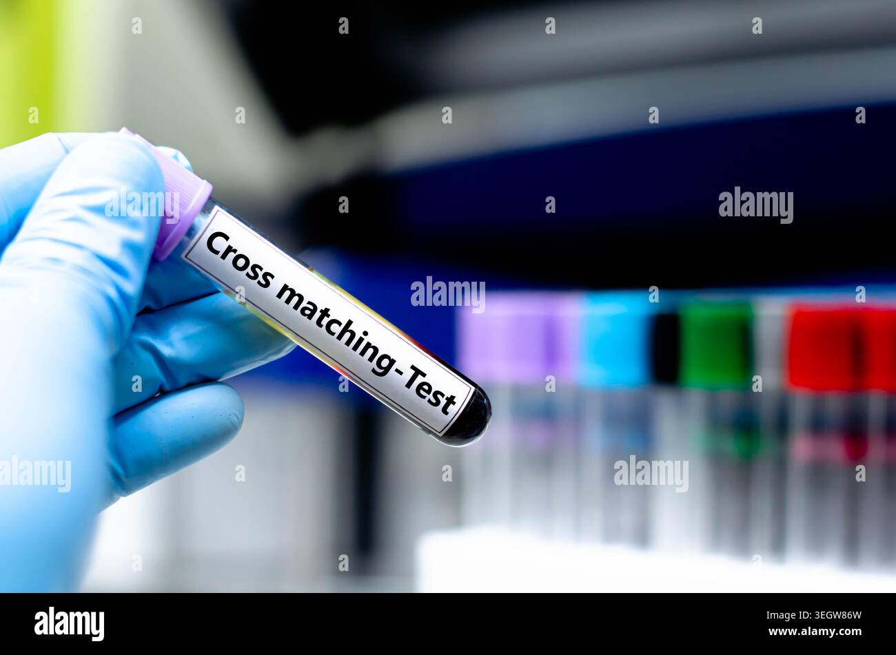 Blutprobenröhrchen für die Analyse des Kreuzversuchs. Stockfoto