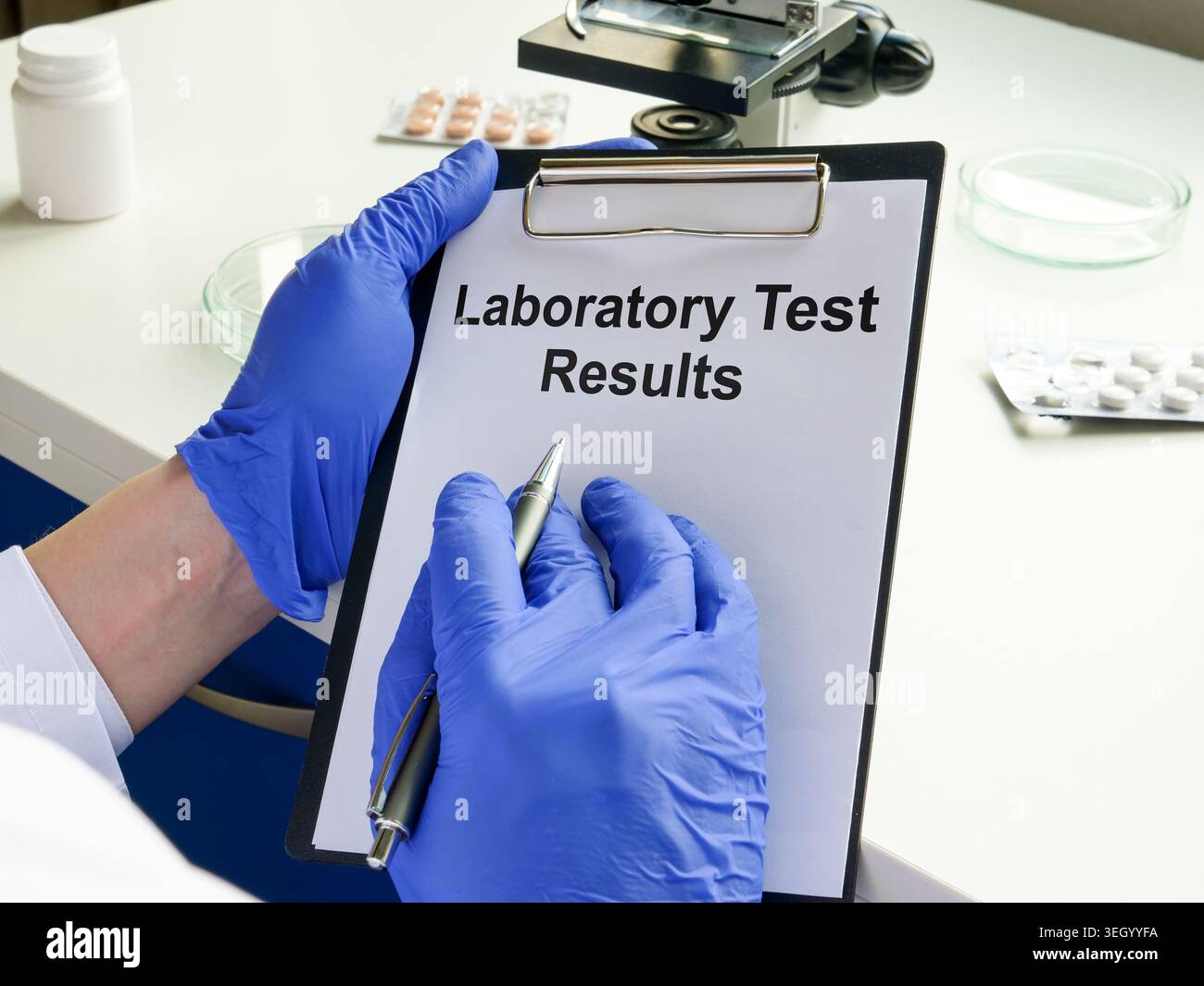 Hände mit Handschuhen, die die Clipboard für Laborergebnisse für die medizinische Diagnostik halten. Stockfoto