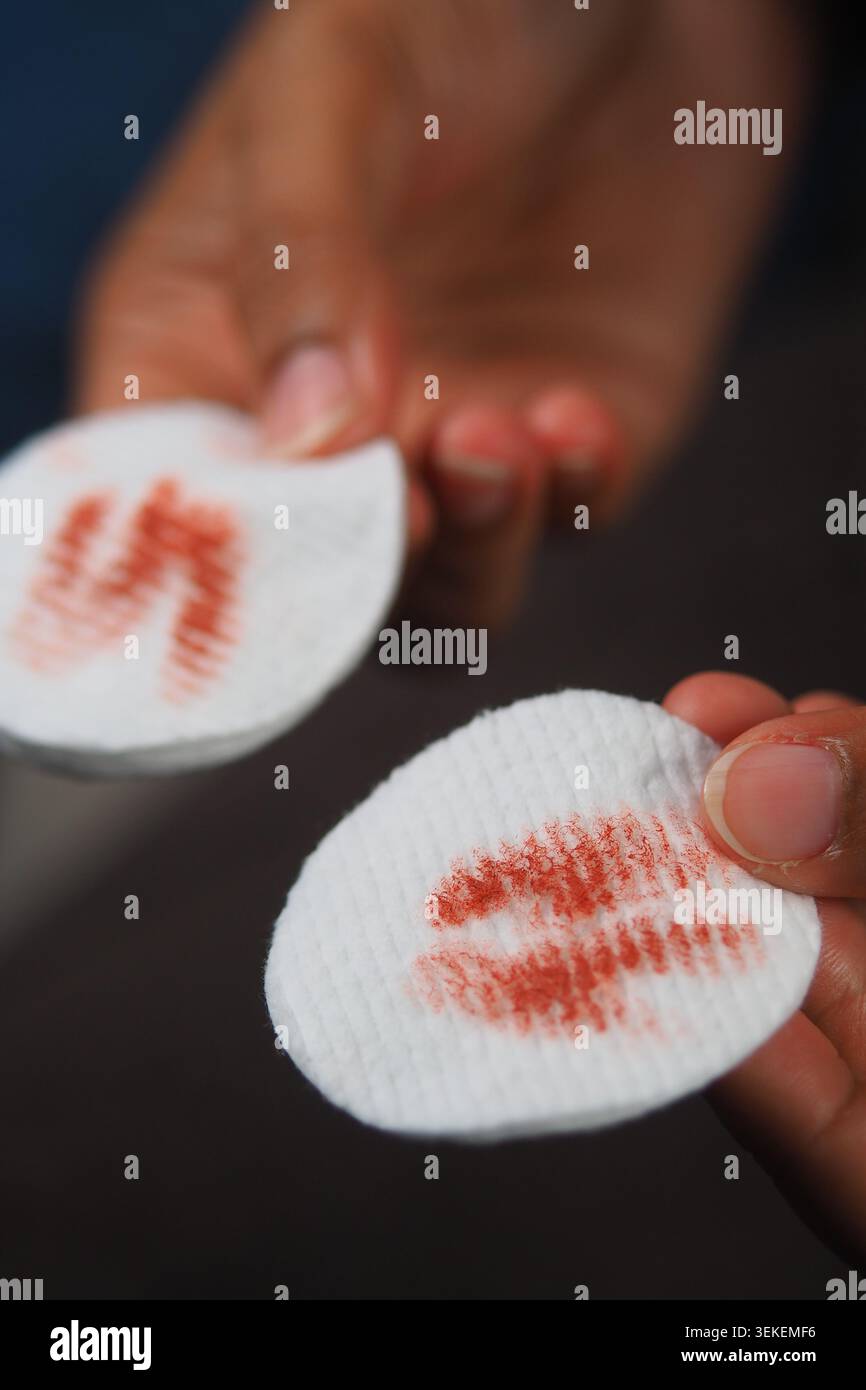 Die Hände zeigen Wattepads mit roten Markierungen vom Lippenstift Stockfoto