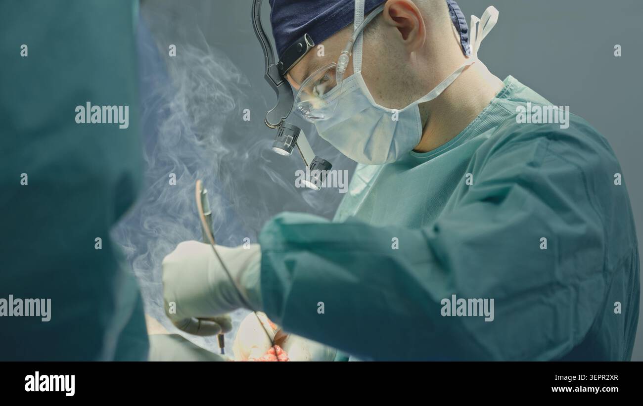 Professioneller Arzt Mann männlicher Chirurg mit Elektrokauterie-Instrument mit Rauch, der präzise neurochirurgische Eingriffe durchführt Operationsarzt Stockfoto