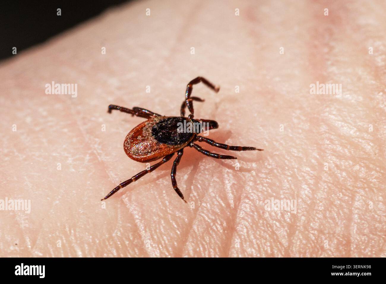 Makronaht einer Zecke, die auf menschlicher Haut krabbelt. Der Parasit kann gefährliche Krankheiten wie Zecken-übertragene Enzephalitis und Lyme-Borreliose übertragen. Konz Stockfoto