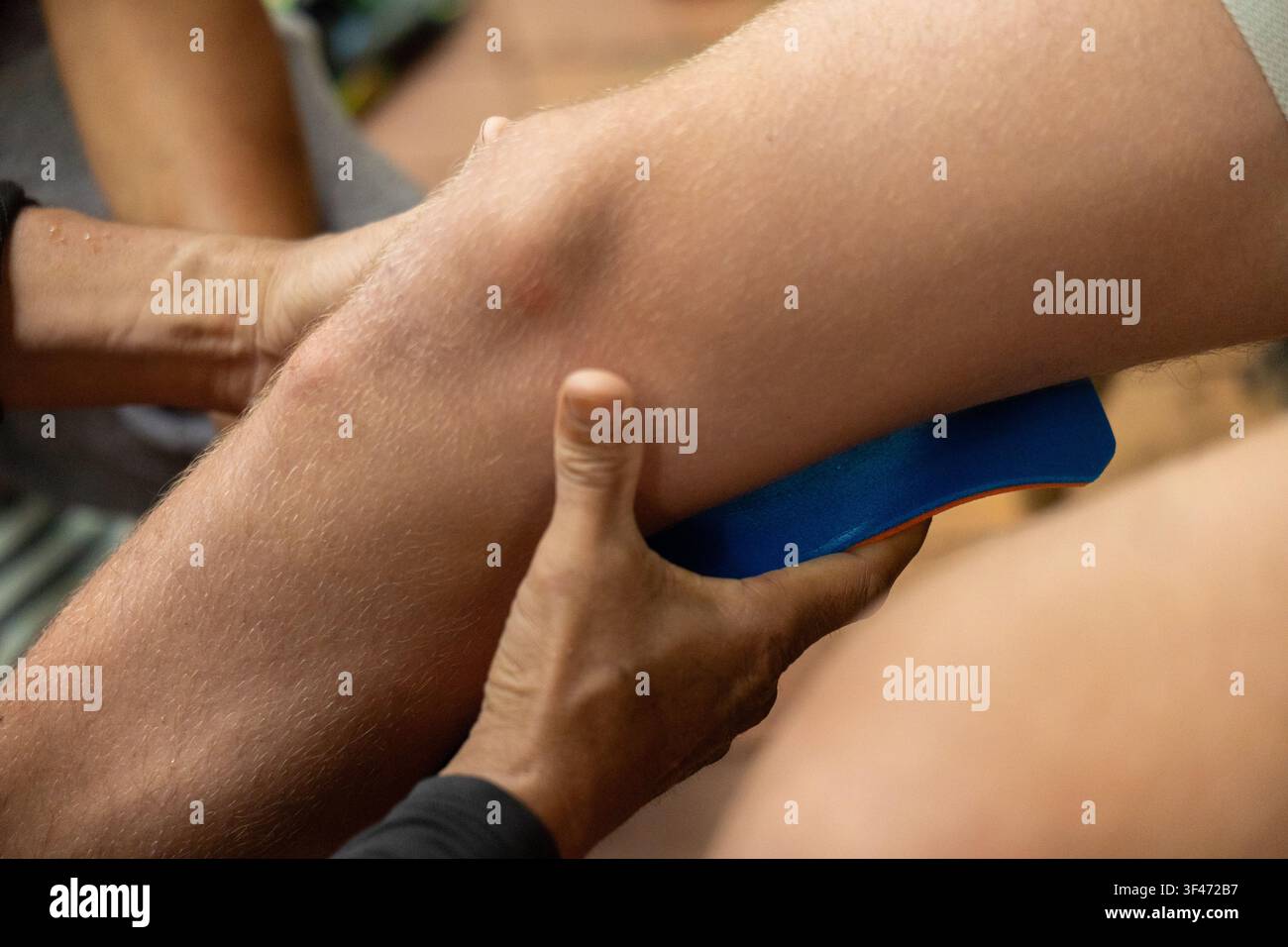 Ein Athlet-Bein-Sporttape-Kinesiotape-Wadenmassage-Physiotherapie-Verletzungsvorbeugung-Trainer-Sportmedizin-Erholung-Haut-Muskel-Übungs-Therapie Stockfoto