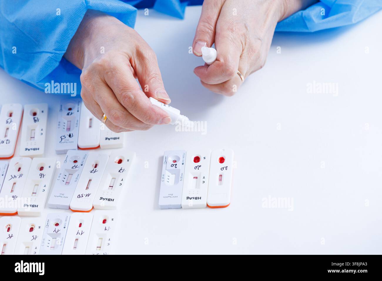 Nahaufnahme der Hände eines Gesundheitsfachpersonals, die eine Pufferlösungs-Pipette über Schnelltestkassetten für HIV-, Syphilis- und Hepatitis-Diagnose halten Stockfoto