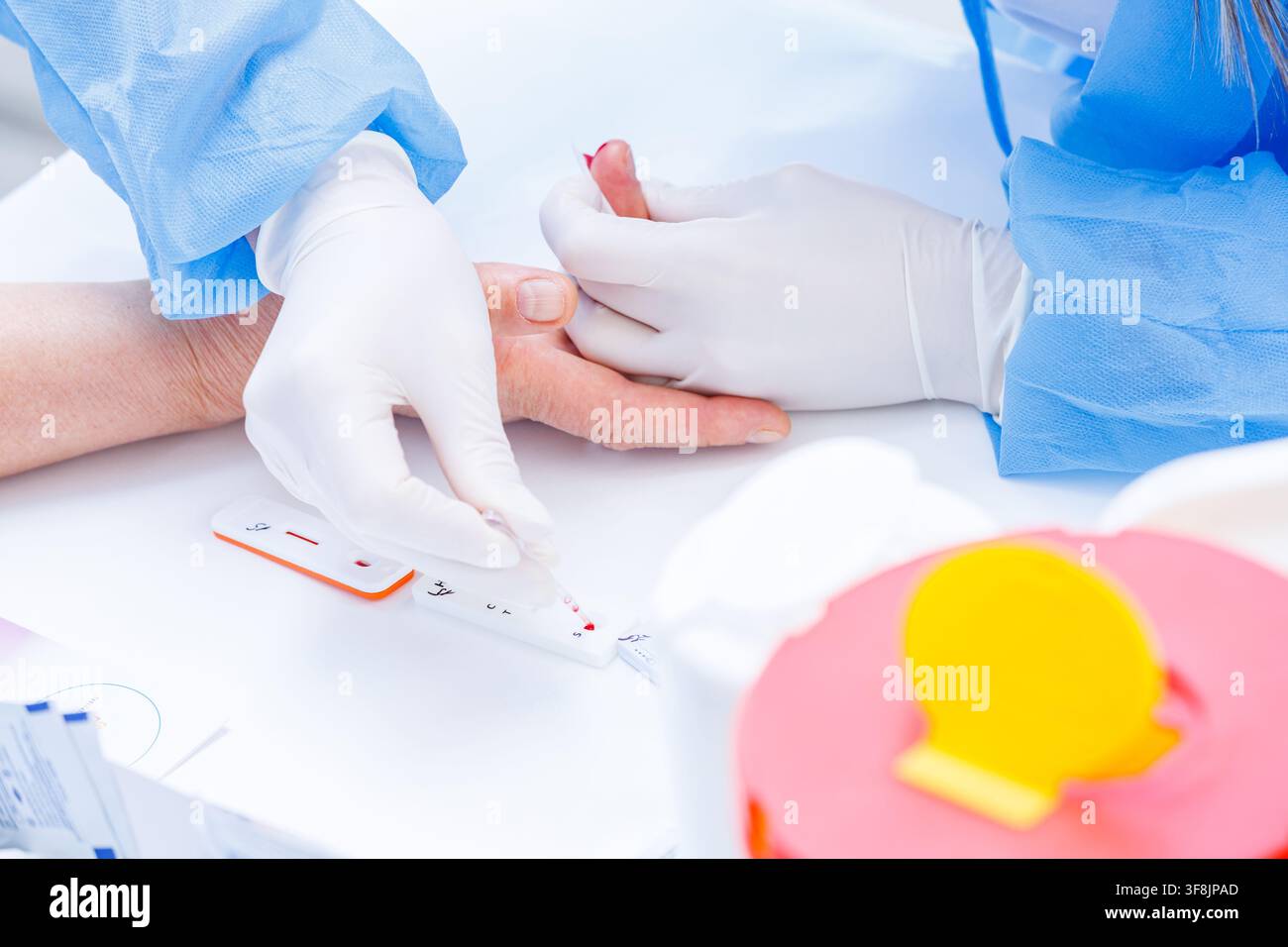 Nahaufnahme einer Krankenschwester in Schutzhandschuhen, die eine Kapillarenblutprobe mit einer Pipette auf ein Schnelltestgerät während einer Seniorenpatientenuntersuchung überträgt Stockfoto