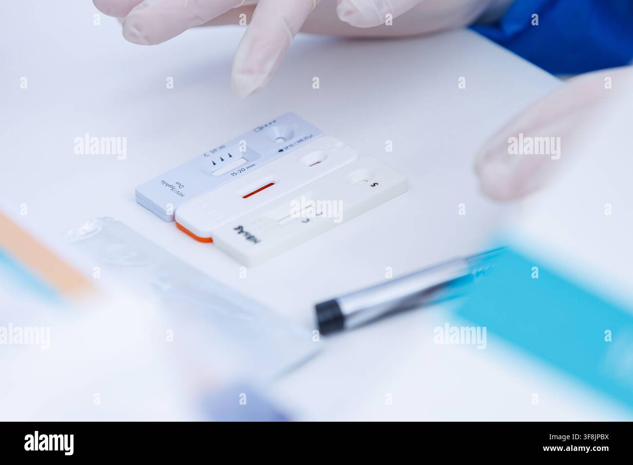 Nahaufnahme von den Händen eines Arztes in Schutzhandschuhen, der schnelle Express-Bluttests mit Testkassettengeräten für HIV, Syphilis und Hepatitis durchführt Stockfoto