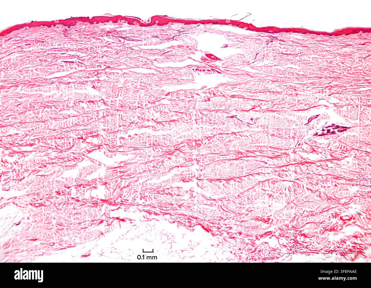 Schweine-Fettzellen, Ganzpräparat, unter Lichtmikroskop. Reife weiße Fettzellen enthalten Lipidtröpfchen. Mit Hämatoxylin-Eosin gefärbt. Stockfoto
