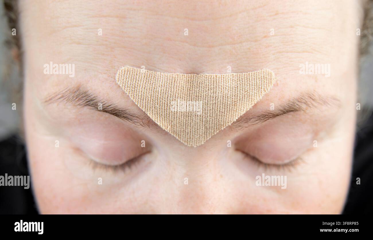 Nahaufnahme eines nicht erkennbaren Gesichts einer 40-jährigen Frau, die einen dreieckigen Stoffpatch zwischen ihren Augenbrauen trägt, um Stirnrunzeln zu reduzieren. Stockfoto