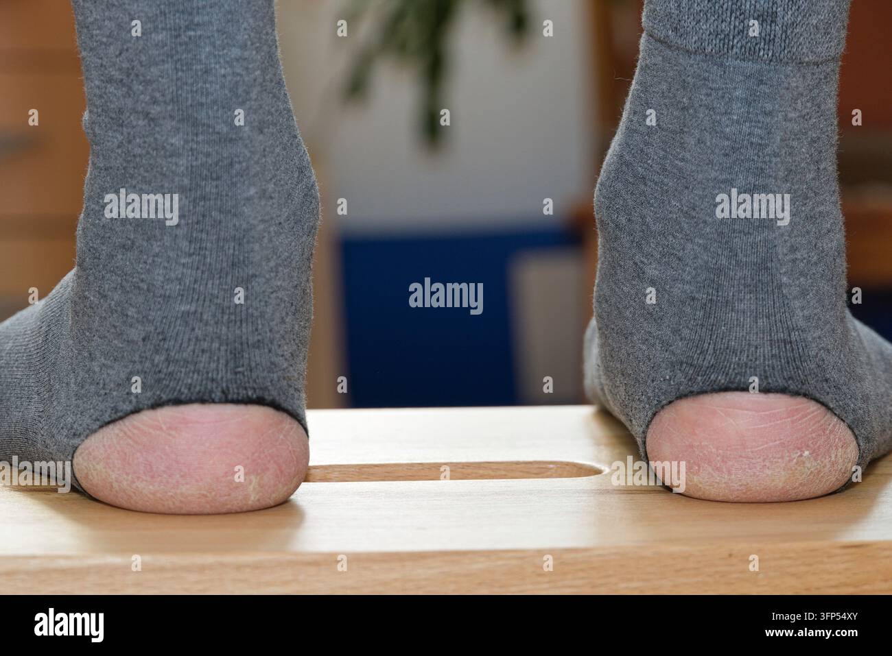 Löcher an den Socken an der Ferse und Schlaufen auf der Haut Stockfoto