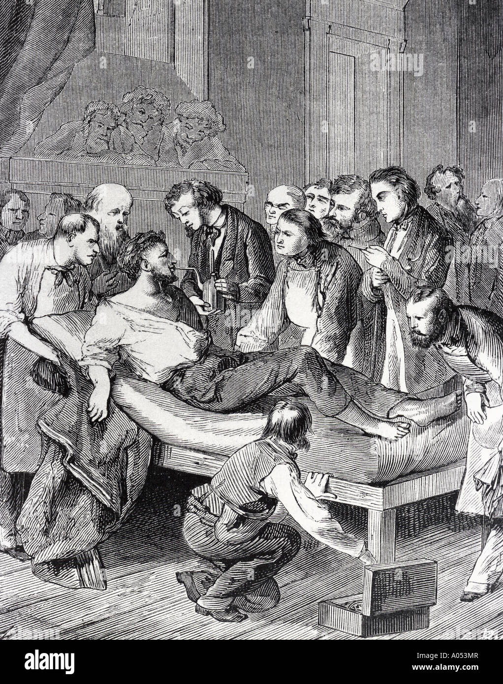 Äther 1847 Gravur zeigt den ersten operative Einsatz von Äther an einem Patienten mit einem Hals-Tumor Stockfoto