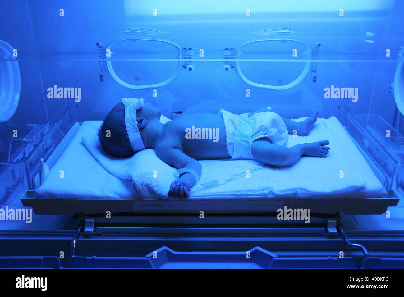 Baby under phototherapy Fotos und Bildmaterial in hoher Auflösung Alamy