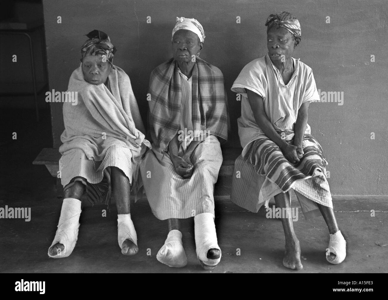 Frauen leiden Lepra warten, bis ihre Füße in einem Krankenhaus aus Ländern der Europäischen Union von Nonnen geleitet. Lepra ist eine Stockfoto