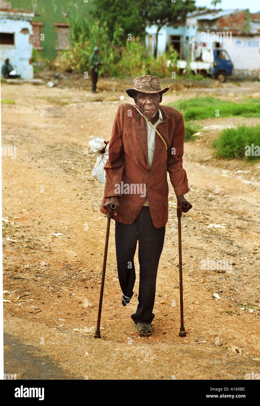 Ein angolanischer Mann, der sein Bein auf eine Landmine verloren geht mehrere Meilen auf Krücken aus einem Lager für Vertriebene Stockfoto
