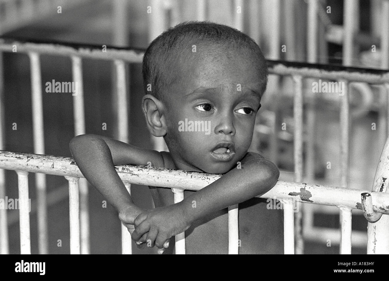 B/W eines Porträts eines schwer unterernährten Kindes, das sich in der Kinderernährungseinheit in einem Krankenhaus in Dhaka, Bangladesch, über sein Kindergeländer gelehnt hat Stockfoto