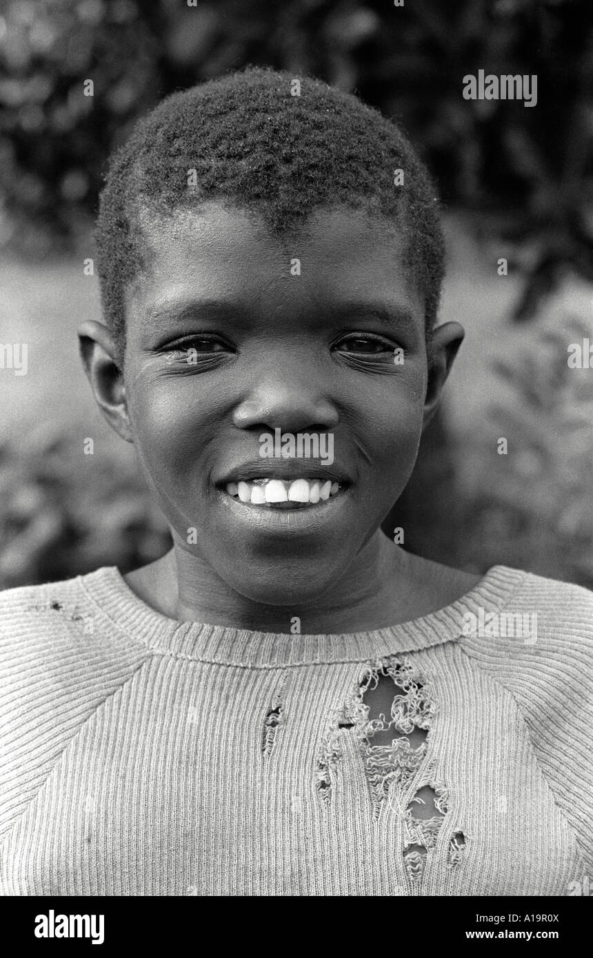 S/W-Porträt eines jungen Mädchens mit Lernschwierigkeiten, das von ihrer Familie verlassen wurde. Kampala, Uganda, Stockfoto