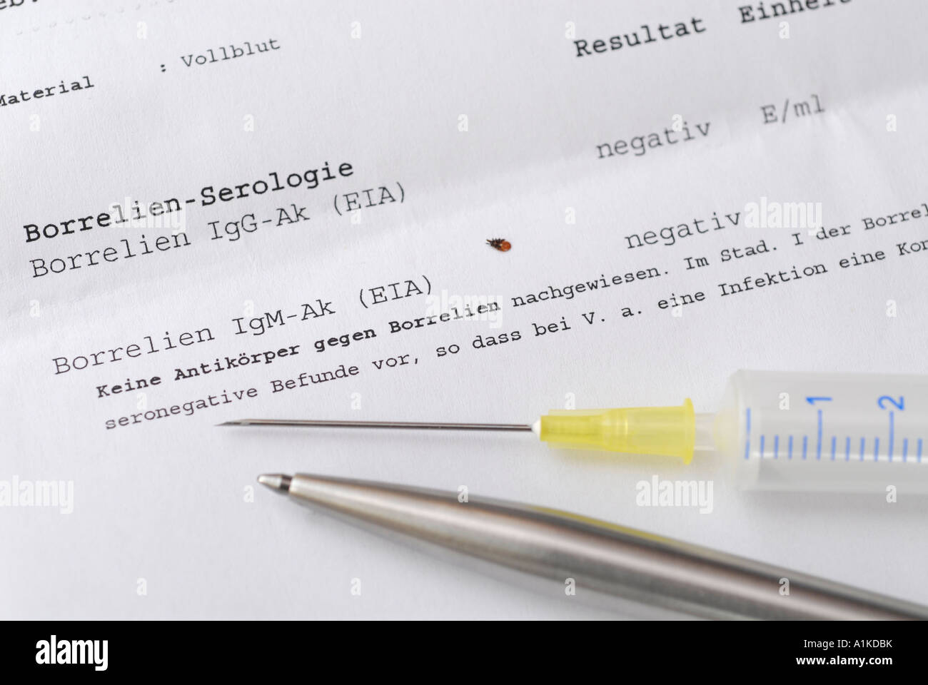 Borreliose Igm Positiv Igg Negativ www.alamy.de