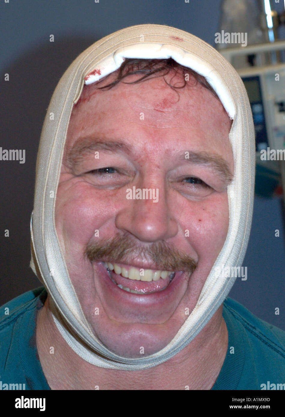 Kompression-Dressing für Kopfhaut Platzwunde Stockfoto