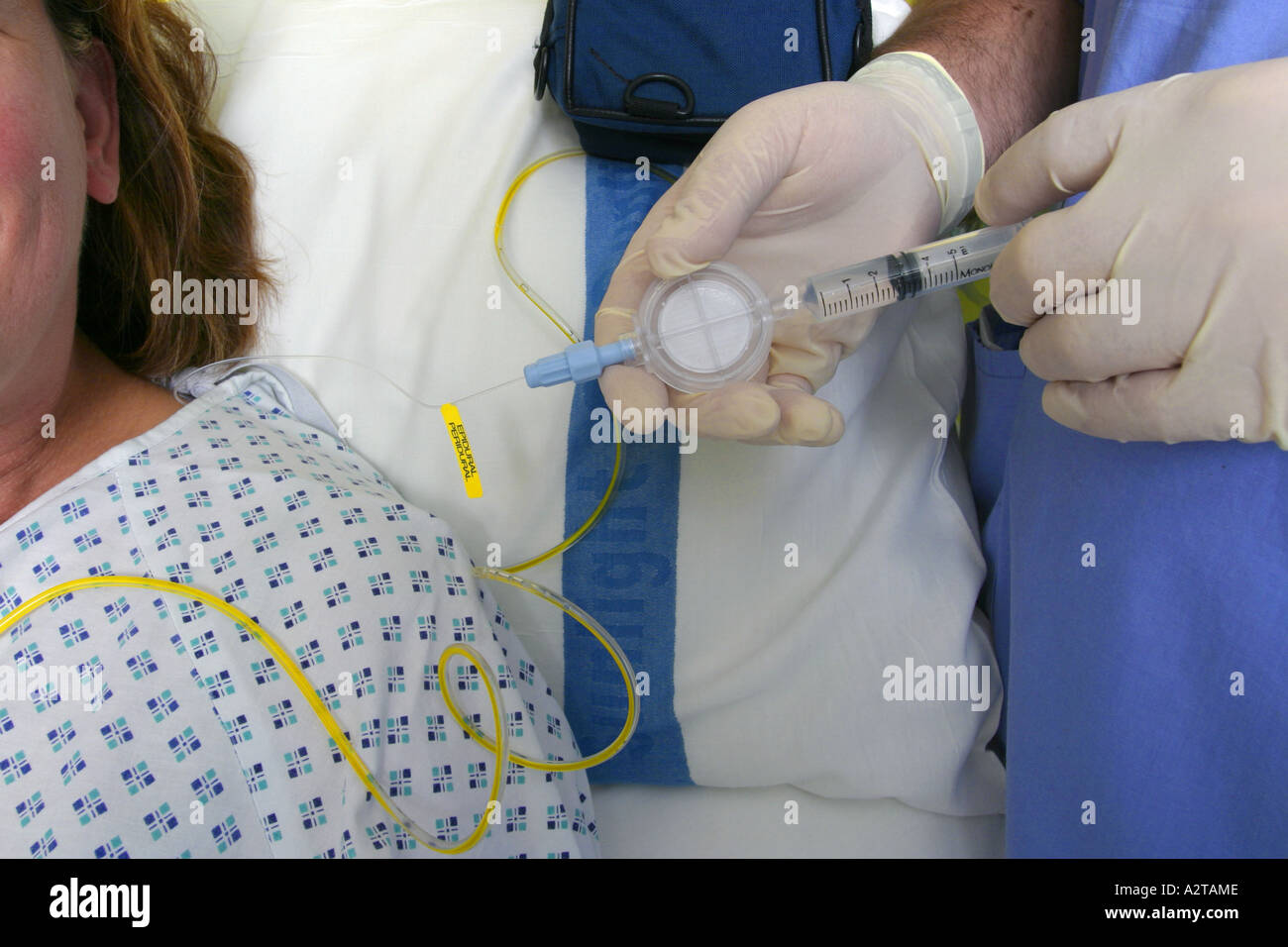 Ein Anästhesist bereitet eine epidurale Anästhesie eine Patientin, die Royal Brompton Hospital in London, 2005. Stockfoto
