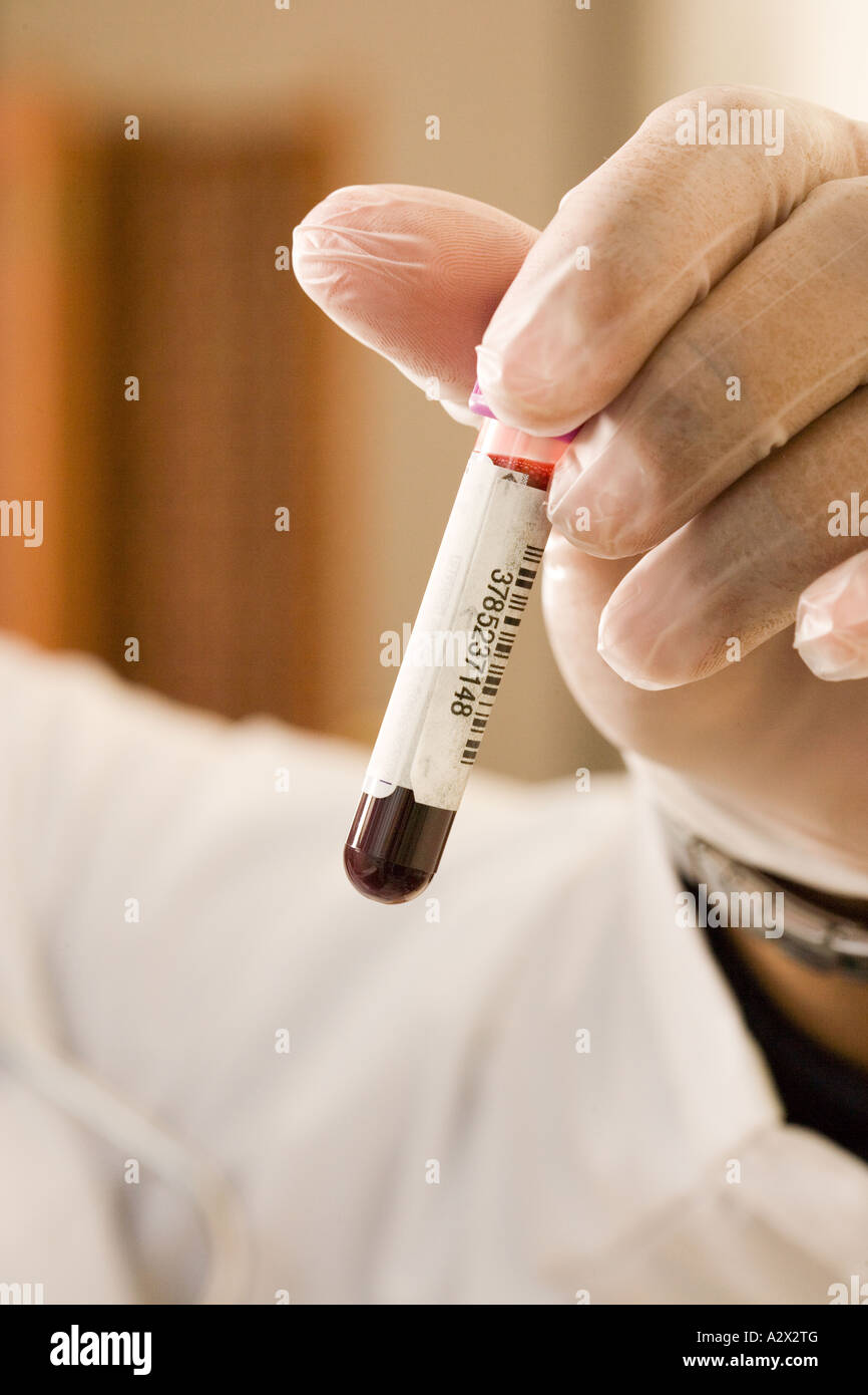Krankenschwester oder Tech hält Phiole mit Blut (real, nicht falsch), nachdem eine Probe des Blutes für eine Blutprobe genommen wurde. Stockfoto