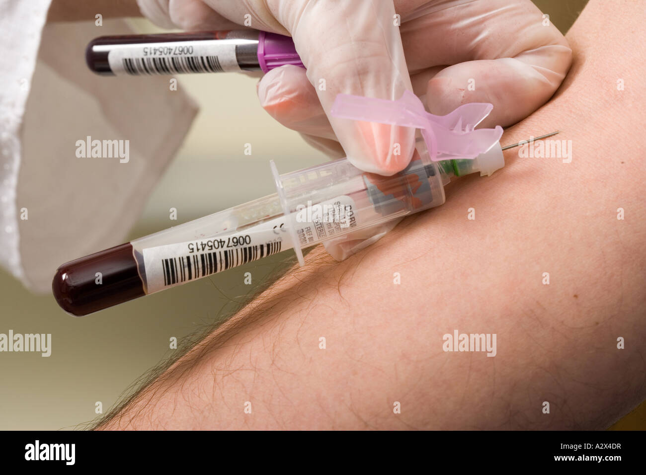 Krankenschwester zieht Blut von Patienten Arm während ein Bluttest durchgeführt. Stockfoto