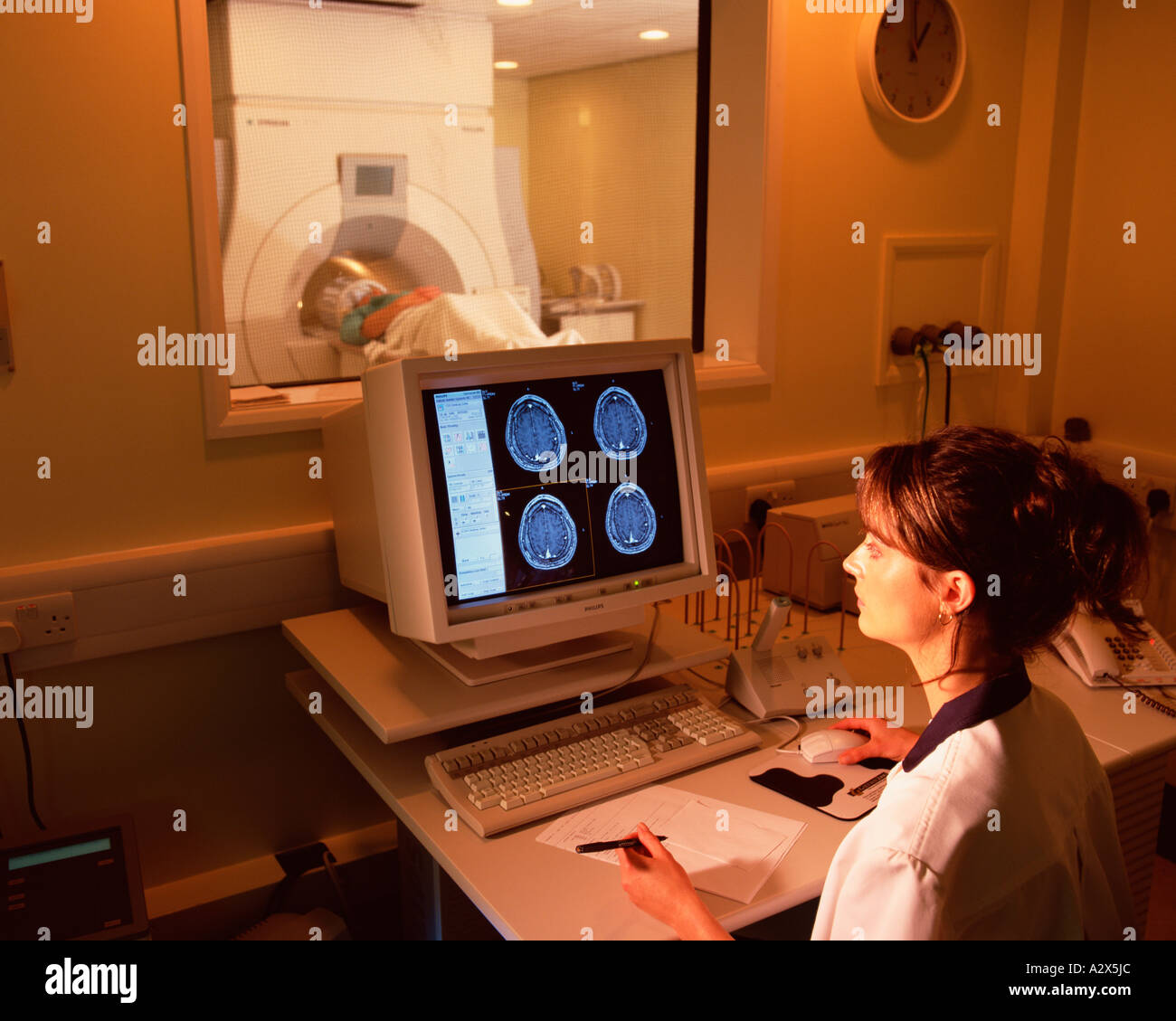 Krankenhaus. Computertomographie (CT). Gehirn-scanning. Stockfoto