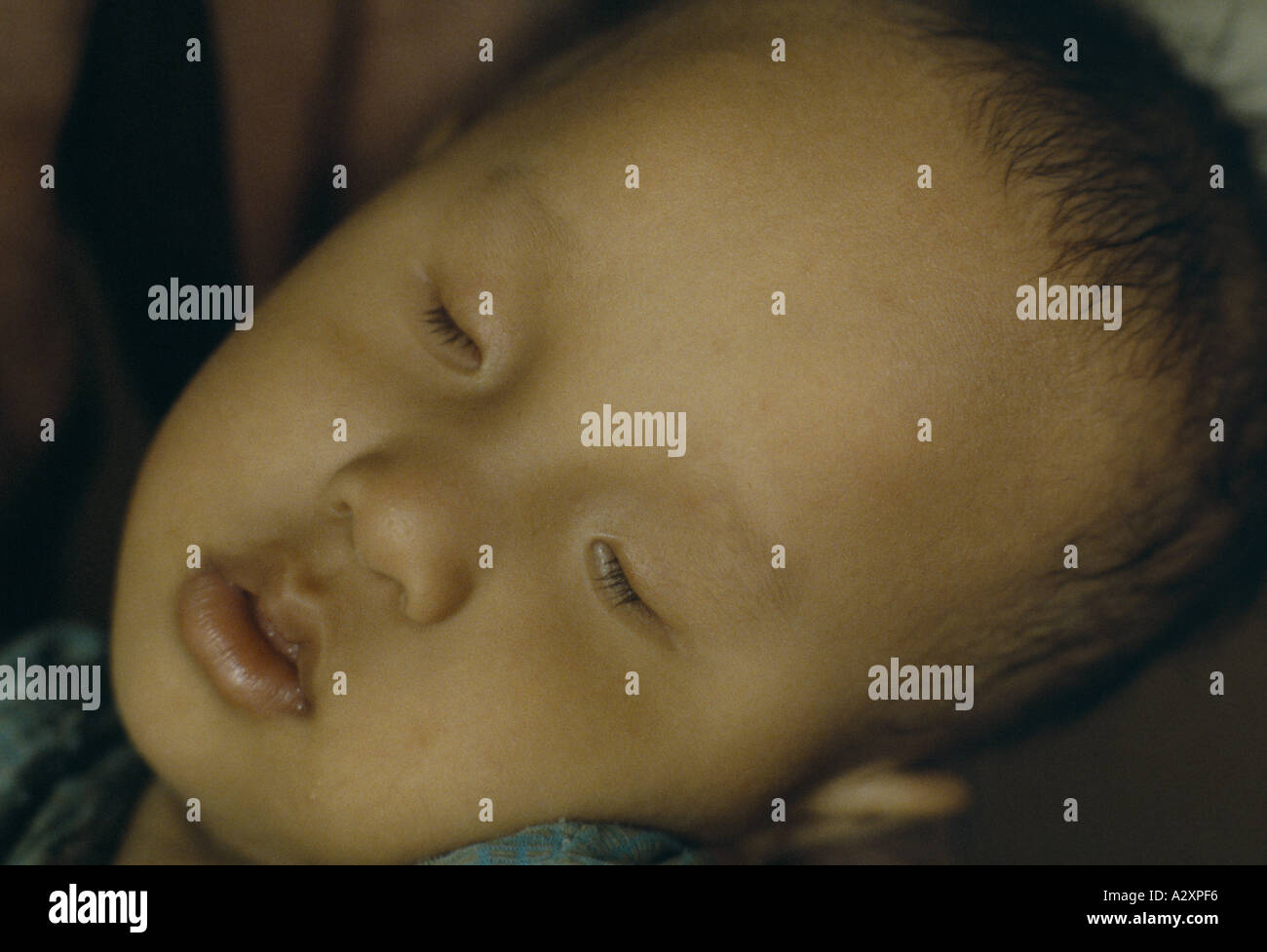 Bui Van Xuan, 20 Monate alt kann weder sprechen, und er hat keine Augen.  Sein Vater, ein Armee-Veteran wurde mit Agent Orange besprüht. Stockfoto
