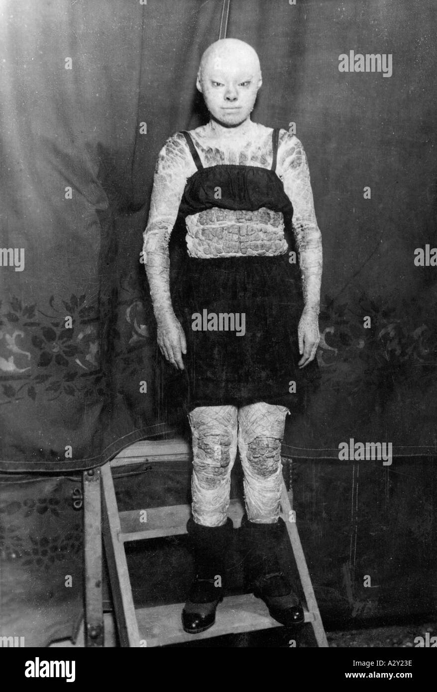 Am 21. Juli 1932 hat ein Fotograf auf einer Messe in Paris eine so genannte Krokodilfrau gesichtet. Ihre Haut ist rau wie eine Echse und gräulich in der Farbe auf einem Jahrmarkt in Paris entdeckt ein Fotograf am 21. Juli 1932 eine sogenannte Krokodilfrau Ihre Haut ist rauh wie die eine Echse und von graeulicher Farbe neugierige Momente S 631 Stockfoto