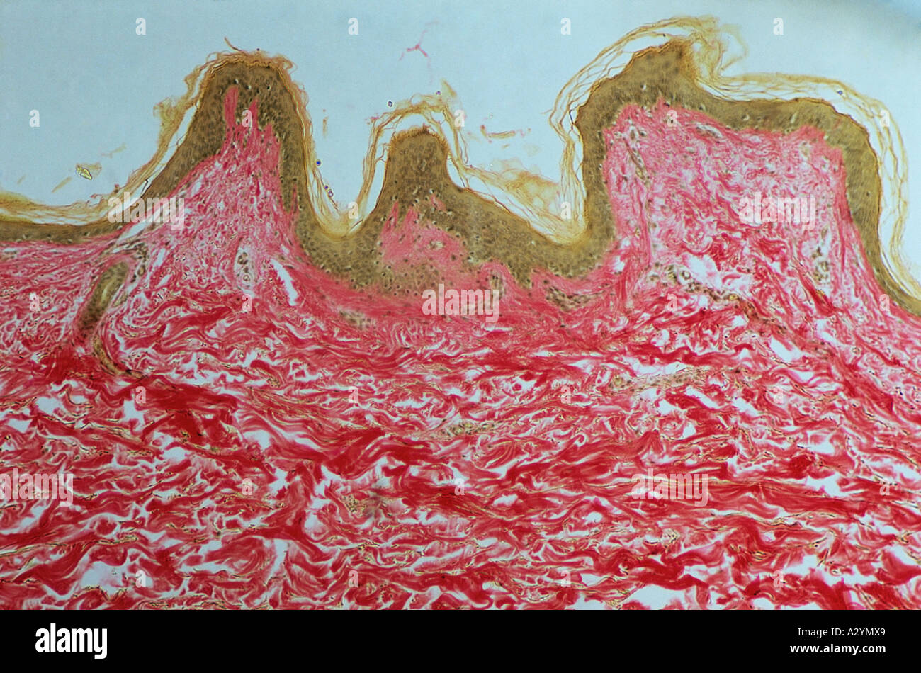 Dermis und epidermis Stockfoto