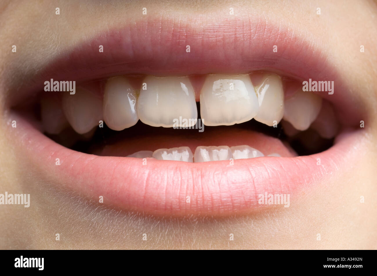 11 elf Jahre altes Mädchen leicht geöffnetem Mund zeigt Nahaufnahme der Zähne und Lippen Stockfoto
