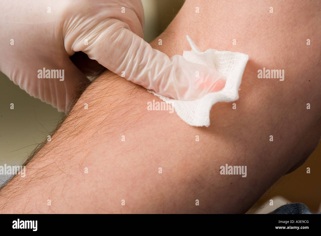 Nach einer einen sterilen Gaze Blutentnahme ist oder Wattepad auf die Punktionsstelle angewendet wird. Stockfoto Nach einer einen sterilen Gaze Blutentnahme ist oder Wattepad auf die Punktionsstelle angewendet wird. Stockfoto