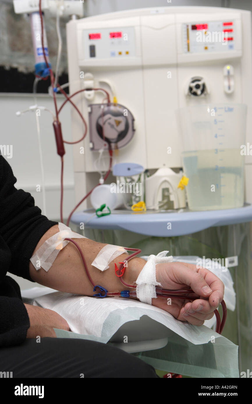 Patient während seiner Dialyse Dialysezentrum im Dominikus Krankenhaus Stockfoto