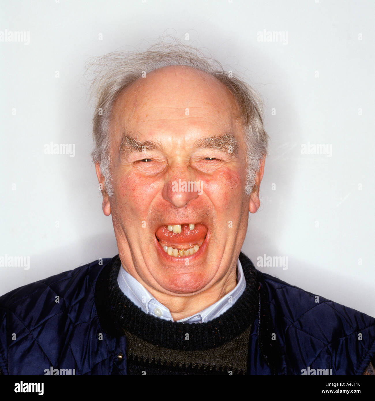 Ältere Menschen mit fehlenden Zahn Stockfoto