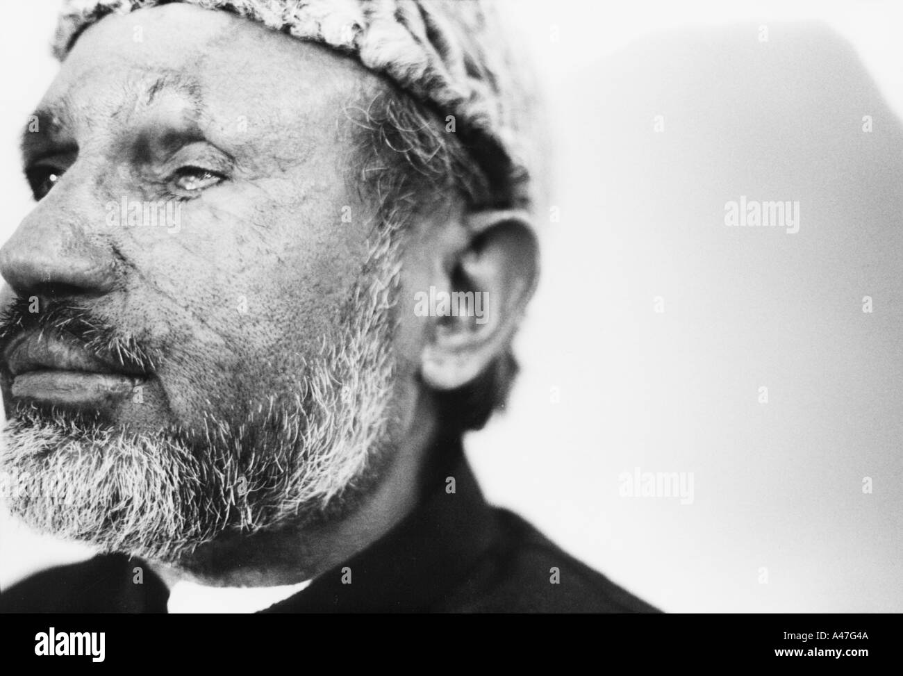 Ein älterer in Rabwah trägt die Narben eines bösartigen Angriffs Ahmadiya Rivalen durch orthodoxe sunnitische Muslime Stockfoto