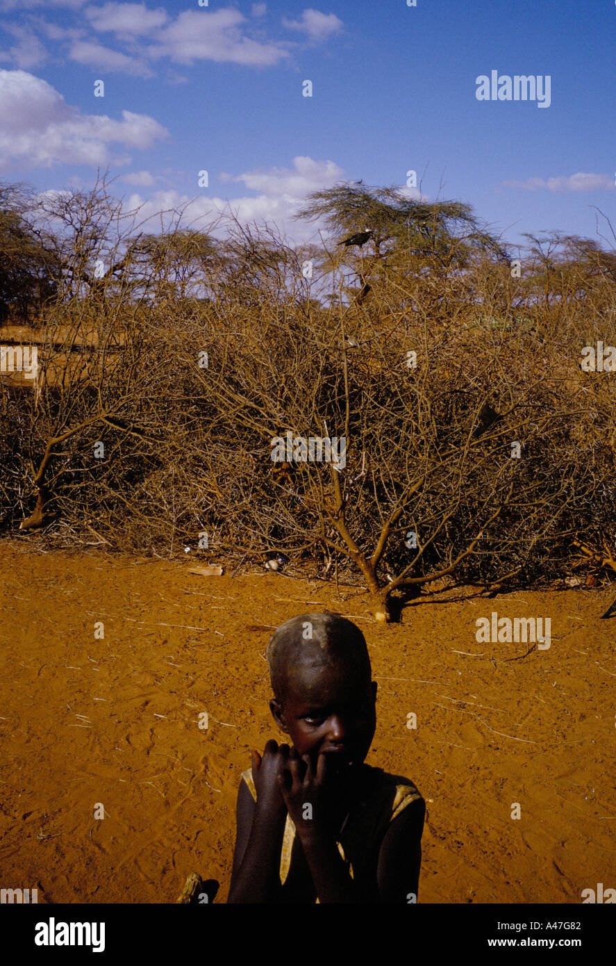 Ein Nomade Kind leidet Mangel an Nahrung in einem Dorf erklärte selbst unabhängige Land in Somaliland Stockfoto