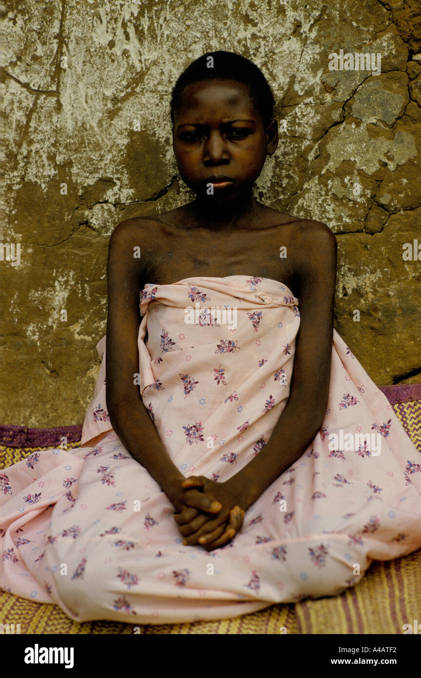 Josephine Naginge im Alter von 26 Jahren, ein krankes und sterbendes Opfer von HIV AIDS. In Dörfern in der Provinz Rakai, Uganda, wurde zu dieser Zeit eine ganze Generation junger Menschen durch AIDS ausgelöscht. Januar 1987 Stockfoto