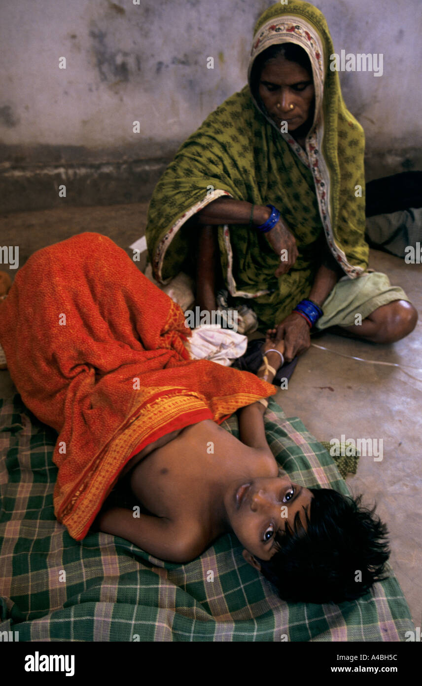 Orissa Wirbelsturm, Indien, 1999: Mädchen leiden unter Durchfallerkrankungen Meerwasser Einrichtungen usw. haben Wasservorräte kontaminiert Stockfoto