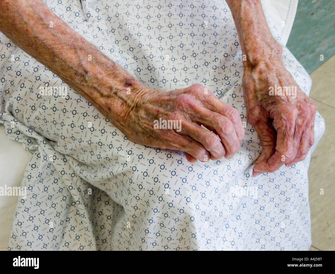 80 Jahre alte Frau ruht nach Whirlpool Behandlung in ein Krankenhaus-Reha-Zentrum Wunde erschöpft Stockfoto