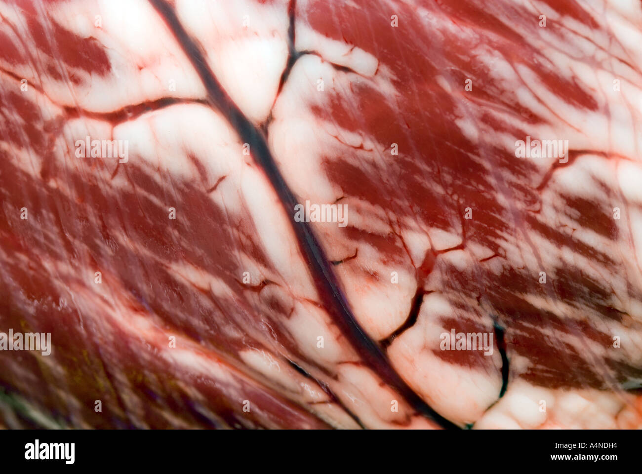 Herzkranzgefäß koronare Herz Herzen Kardiologie Fett Mast adipösen Muskel myo Stockfoto