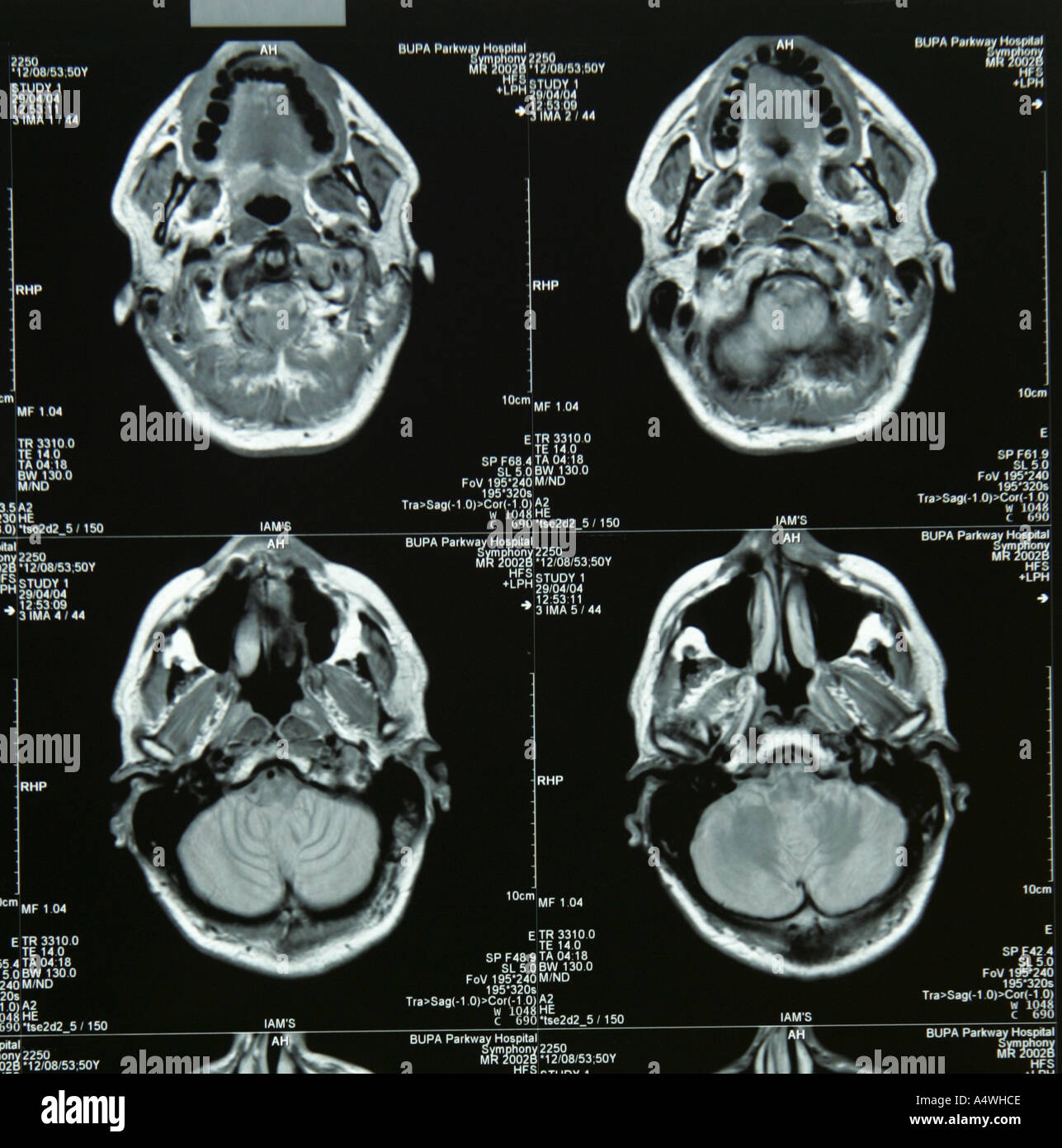 CAT-Scan Stockfoto