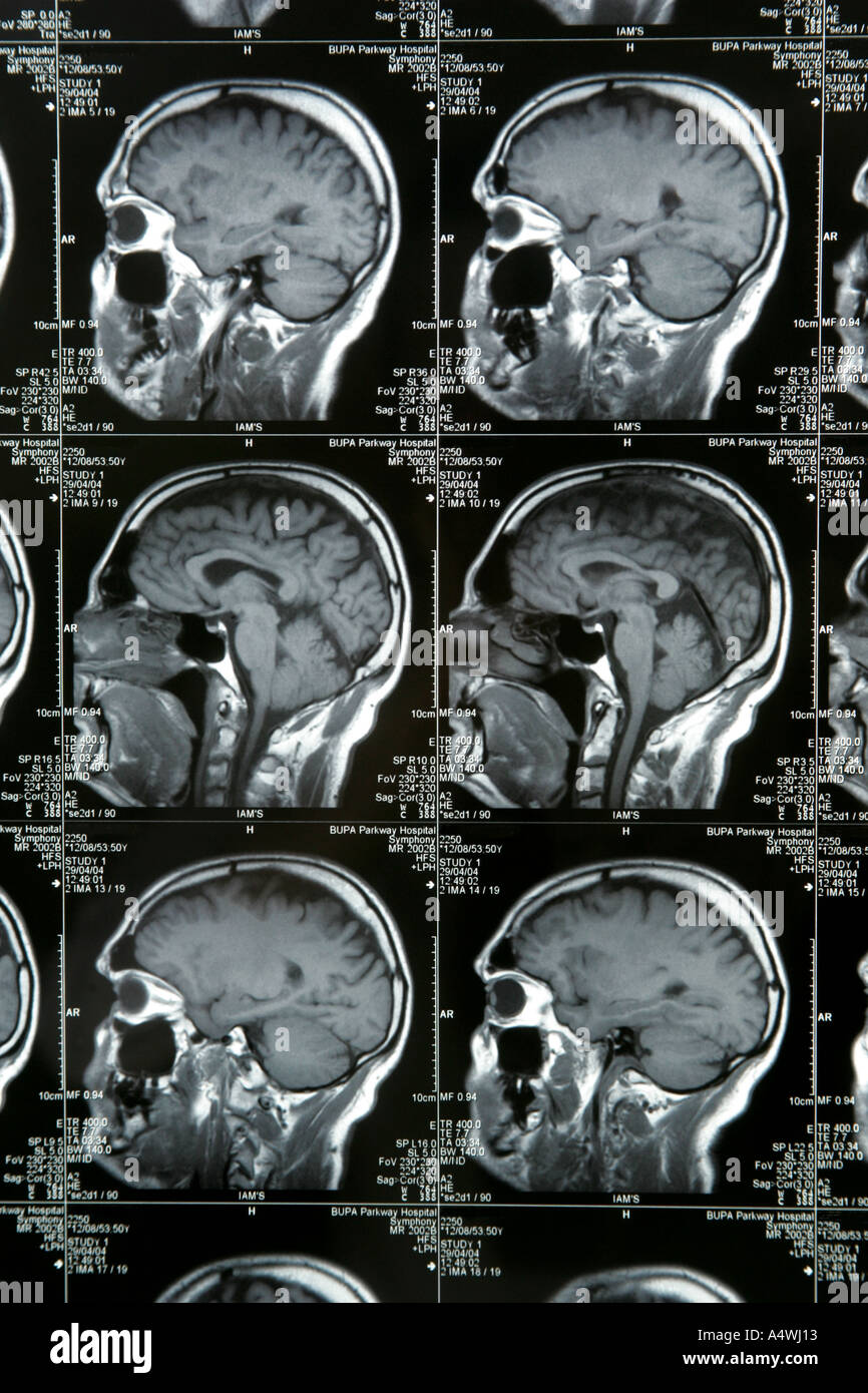 CAT-Scan Stockfoto