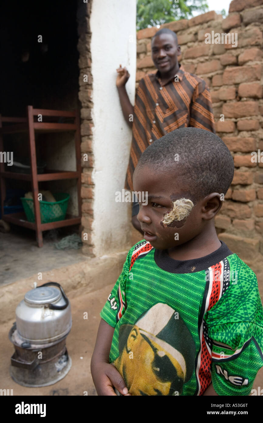 Bleibt eine rudimentäre Dressing auf ein Junge verletzt bei einem Zusammenstoß mit dem Fahrrad in das Dorf Buli, Malawi, Afrika Stockfoto