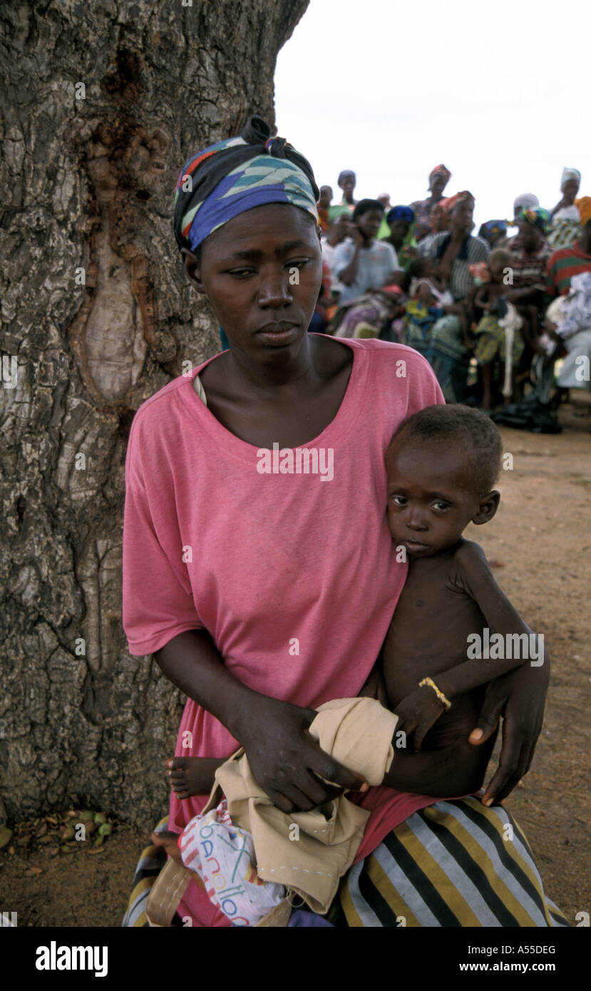 Painet ik0307 Ghana Womanand unterernährten Kind Bongo Bolgatanga Land entwickeln Nation weniger ökonomisch entwickelt Stockfoto