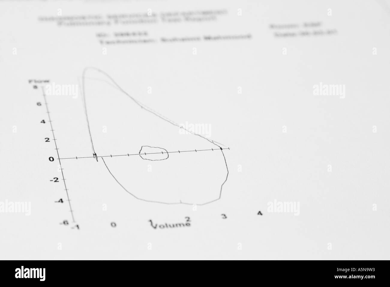 Spirometrie-Diagramm aus einer Lunge/pulmonale Funktionstest (PFT) verwendet, um die Atemwege zu diagnostizieren. Stockfoto